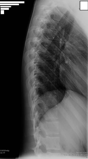 Radiografía Lateral Dorsal